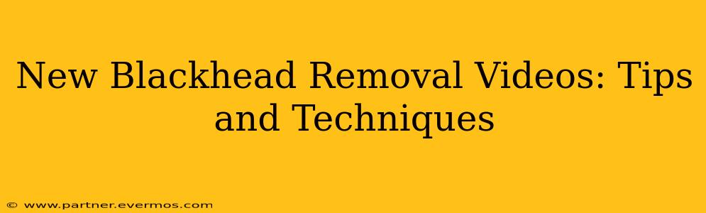 New Blackhead Removal Videos: Tips and Techniques