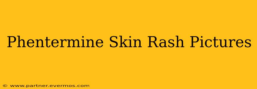 Phentermine Skin Rash Pictures